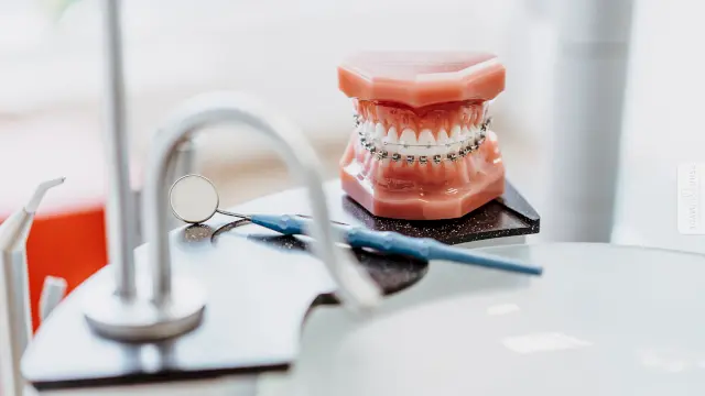 Zahnespangen-Arten für Erwachsene und Kinder