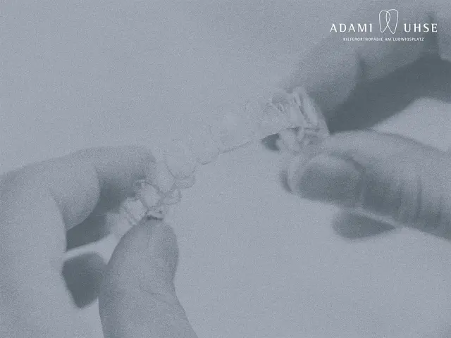 Aligner von Invisalign